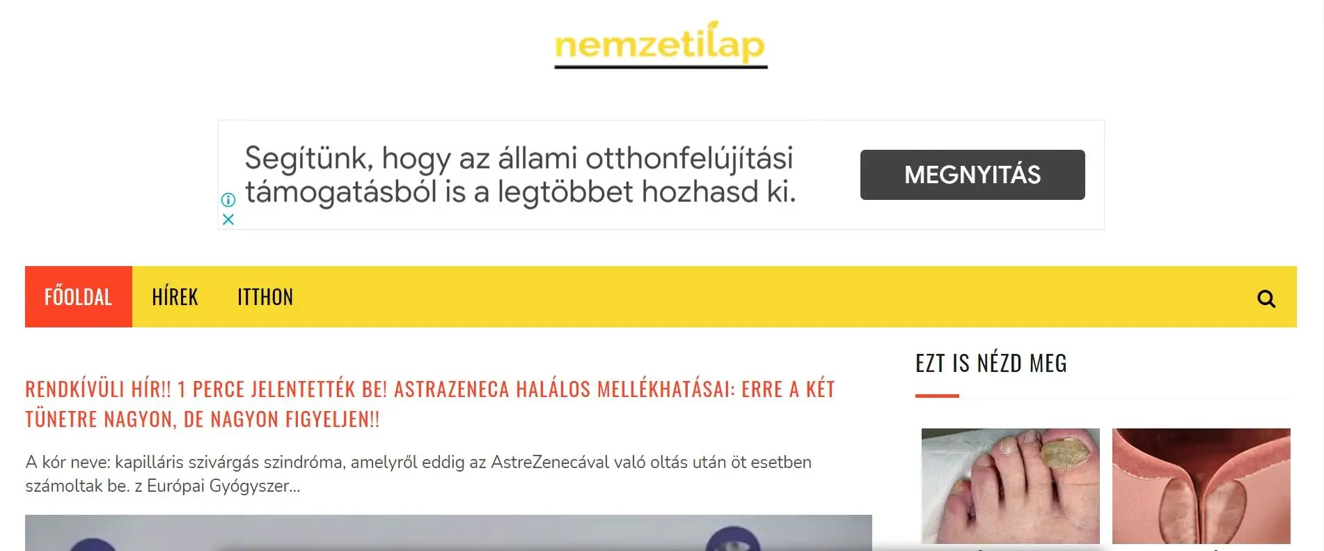 Szele Tamás: Sajtóparaziták thumbnail
